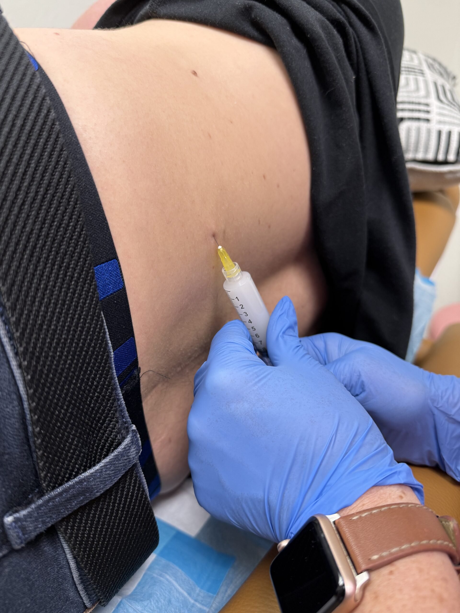 Hormone Replacement Therapy (HRT) for Men: What It Is and Benefits