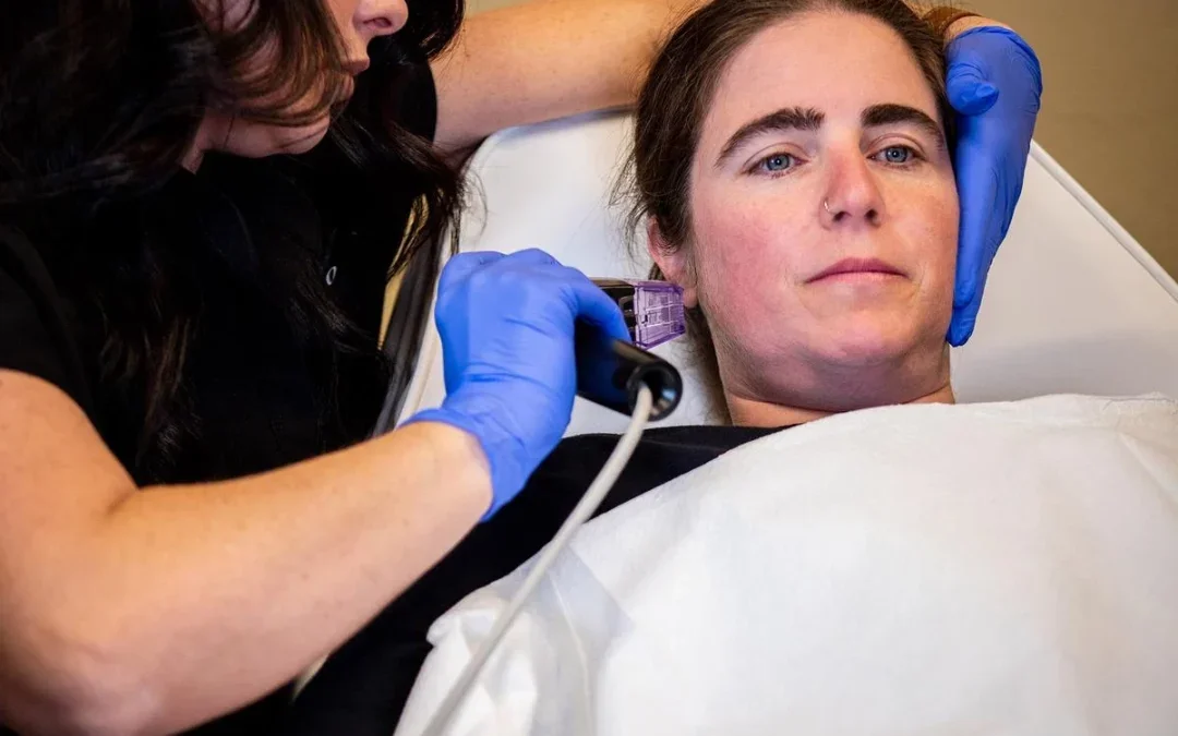Morpheus8 vs. Traditional Facelift: Comparing Results and Benefits