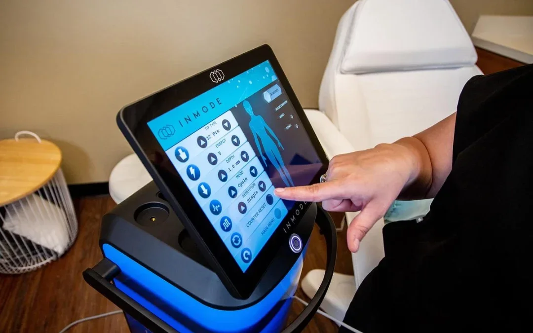 Does Morpheus8 Help Treat Acne Scars in Edmond, OK?