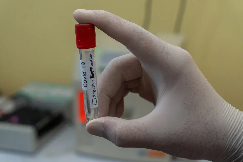Coronavirus: Diagnosis and Testing of COVID-19