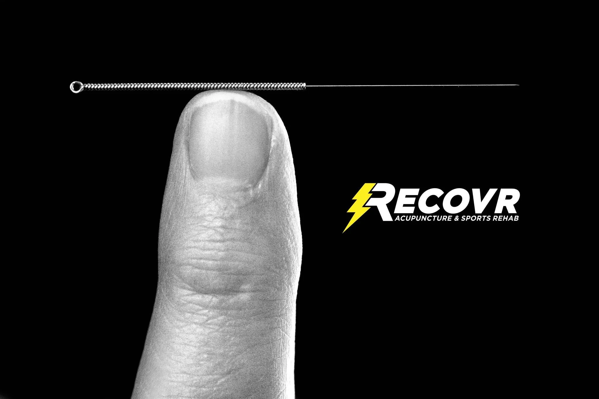 The Profound Benefits of Acupuncture