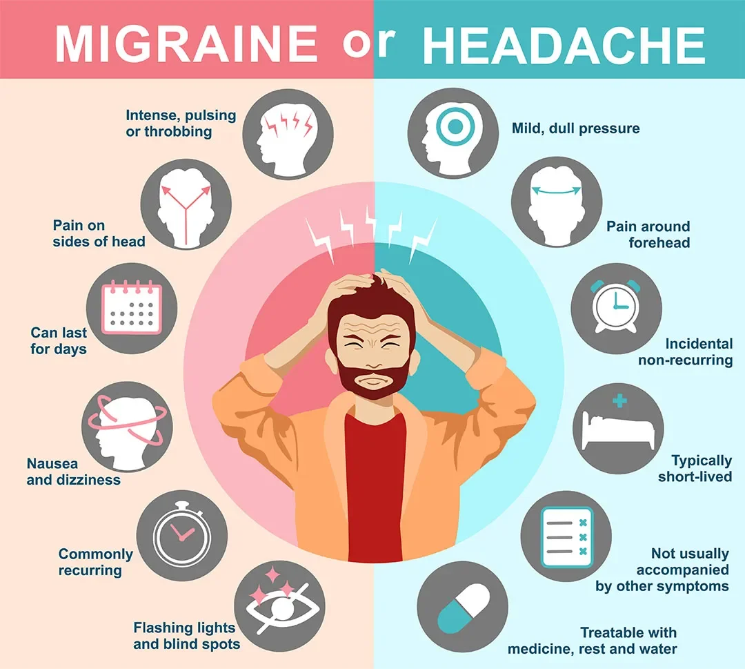 Acupuncture for Migraines