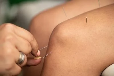 Understanding the Mechanisms of Acupuncture in Alleviating Knee Pain