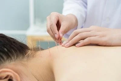 The Role of Acupuncture in Relieving Chronic Neck Pain