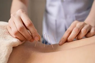 How Acupuncture Promotes Natural Healing for Back Pain