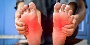 Can Acupuncture Help Neuropathy?