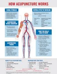 Does Acupuncture Really Work? Here’s What Science and Experience Say