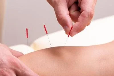 A Holistic Approach to Knee Pain Using Acupuncture, Manual Therapy, and More