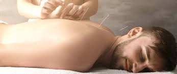 How many acupuncture sessions do i need to see results?