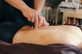 How long does an acupuncture session last