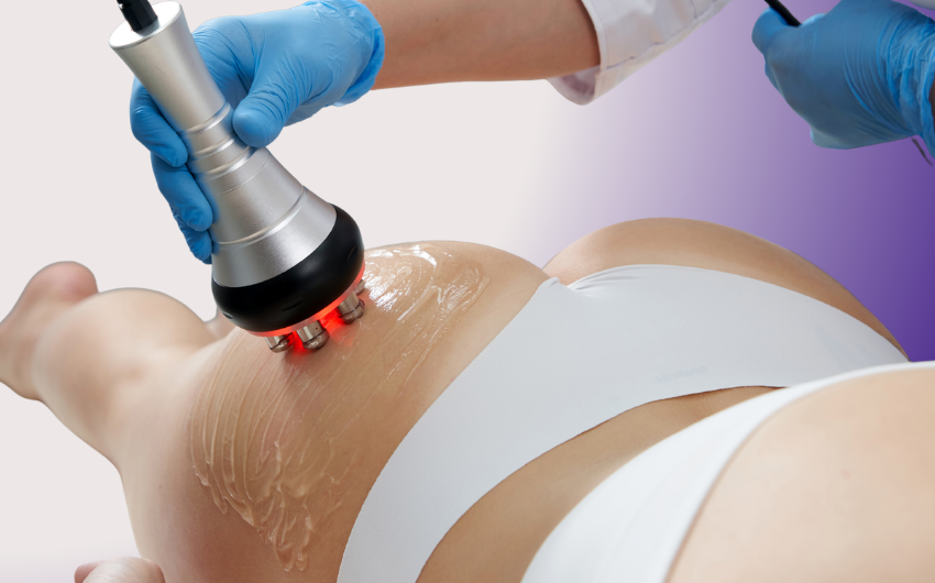 Emsculpt Neo helps build muscle and reduce fat simultaneously using a combination of radiofrequency heating and high-intensity electromagnetic energy, improving body tone and definition without surgery.