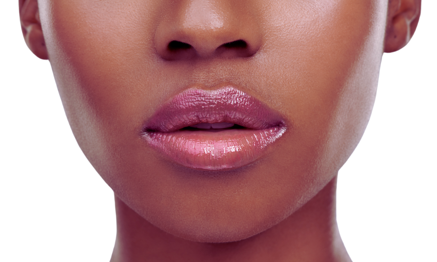 Lincoln, NE. Medical Spa. Med Spa. Aesthetics & Wellness. Best. RN Injector. Nurse Injector.
Lip filler, dermal filler, lip enhancement, fuller lips, natural lip augmentation, lip volume, hyaluronic acid filler, juvederm, natural filler