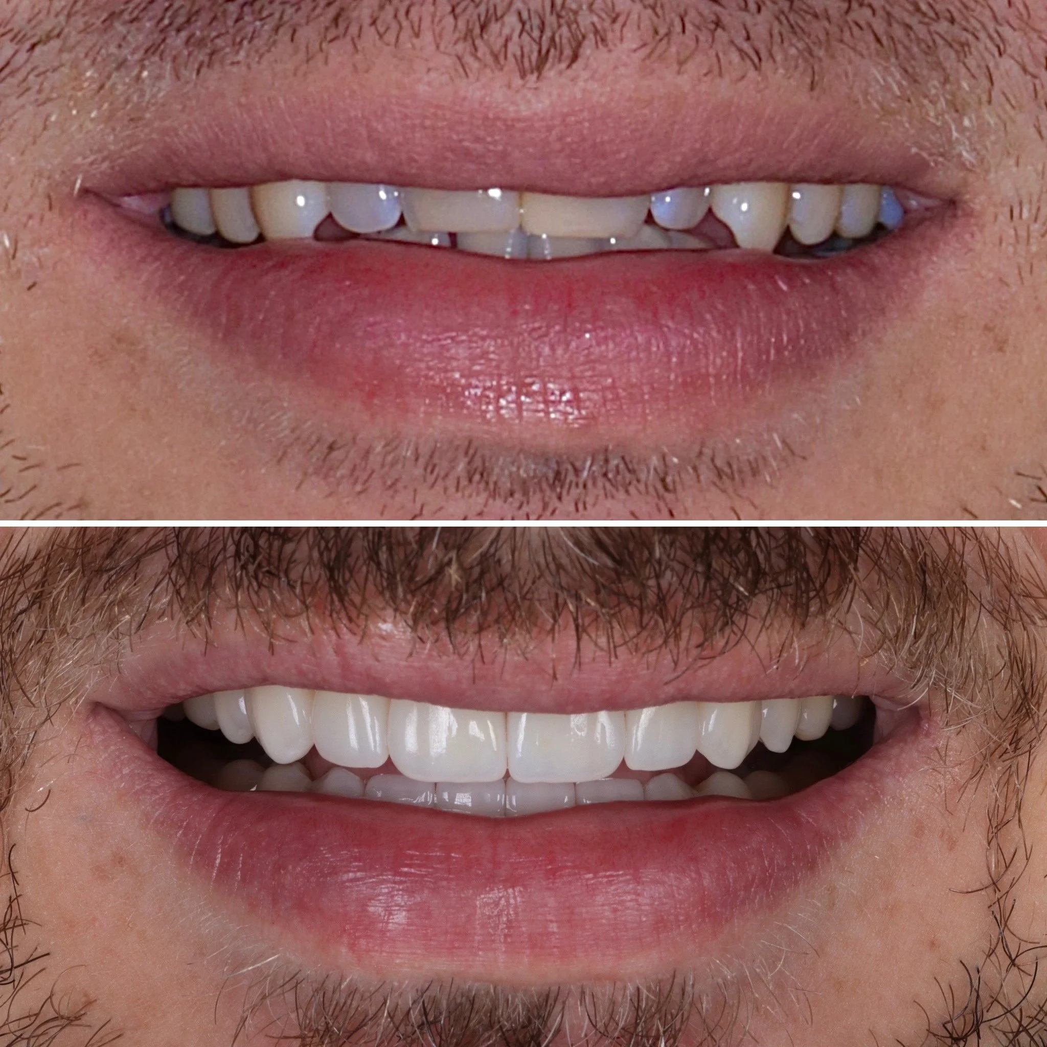 reabilitacao3.jpg