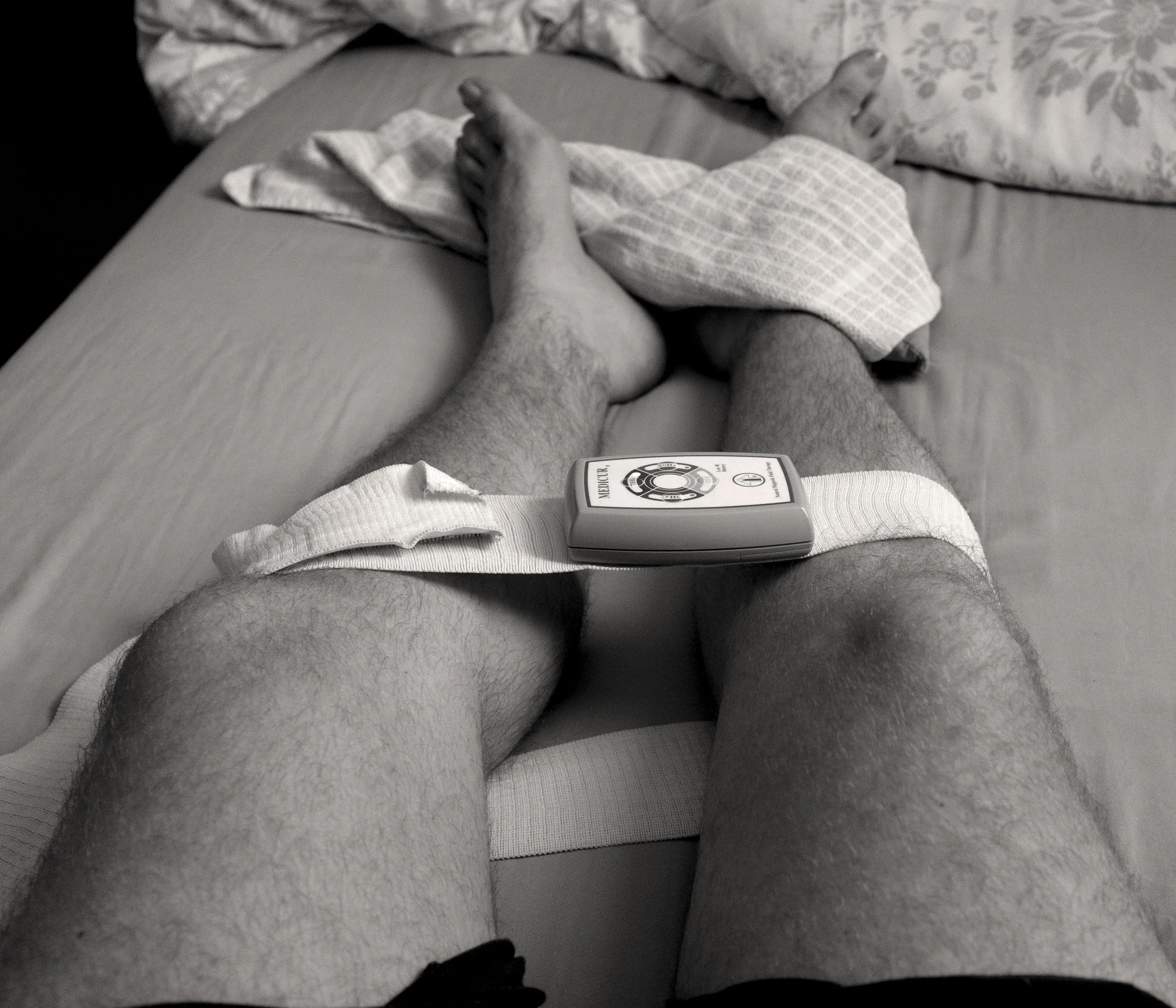 A person lying in bed with a monitor attached to their thigh, with their legs stretched out, in a black-and-white photo.