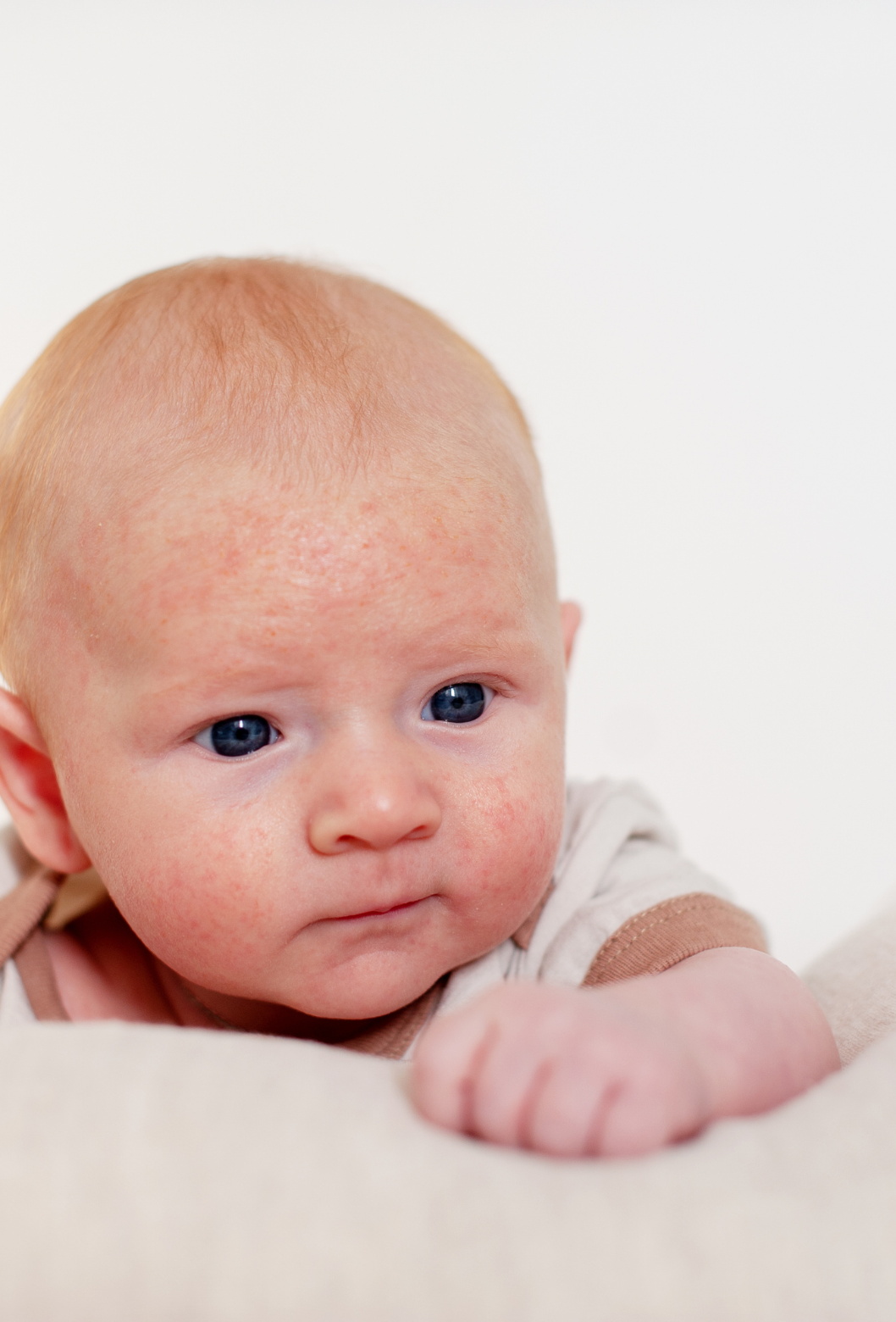 Bebê de cabelo ruivo, olhos azuis, com pele avermelhada, olhando para frente, apoiado em uma superfície