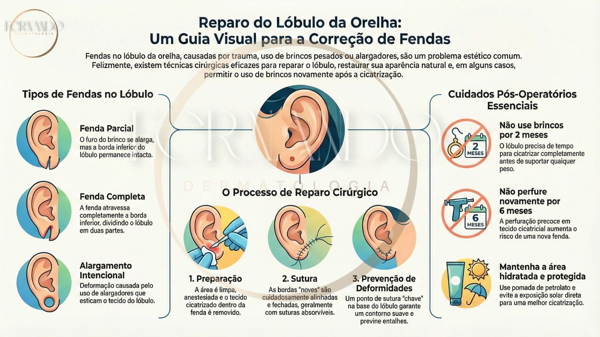 Infográfico mostrando os tipos de fenda de orelhas, como é feito o reparo cirúrgico e como deve ser feito o manejo no pós-cirúrgico.