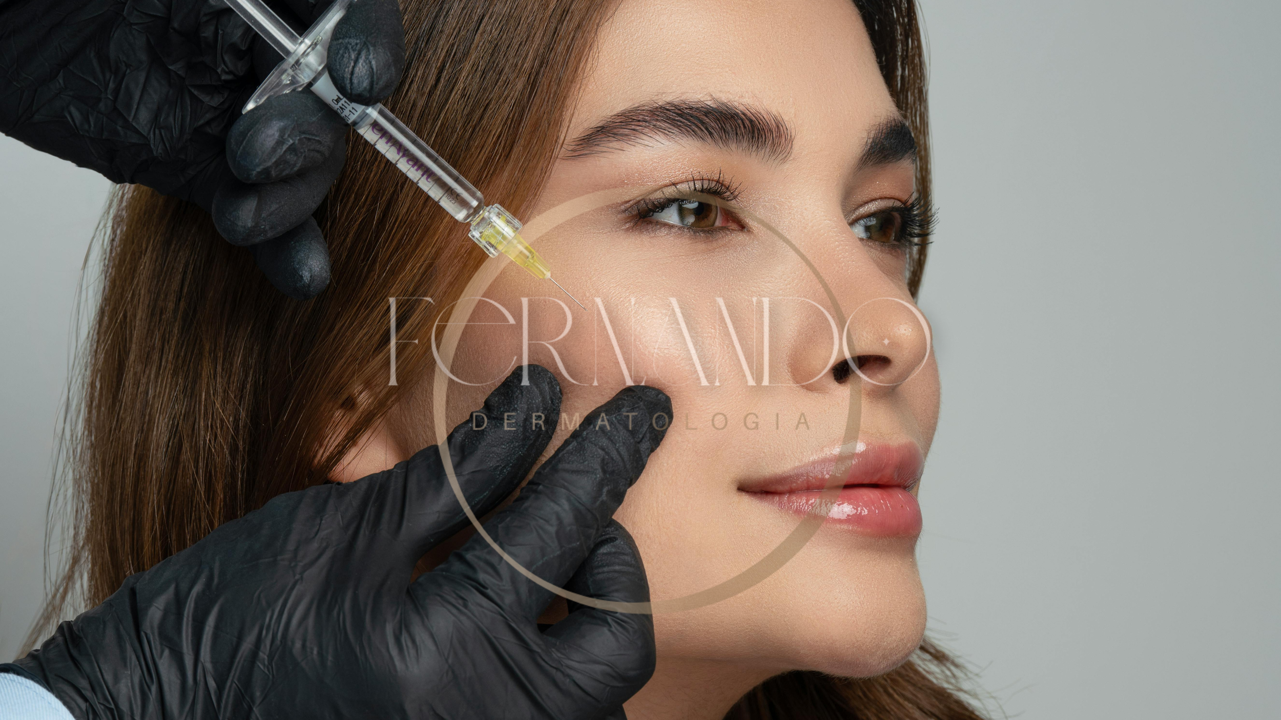 Mulher sendo tratada na região do malar com ácido hialurônico
