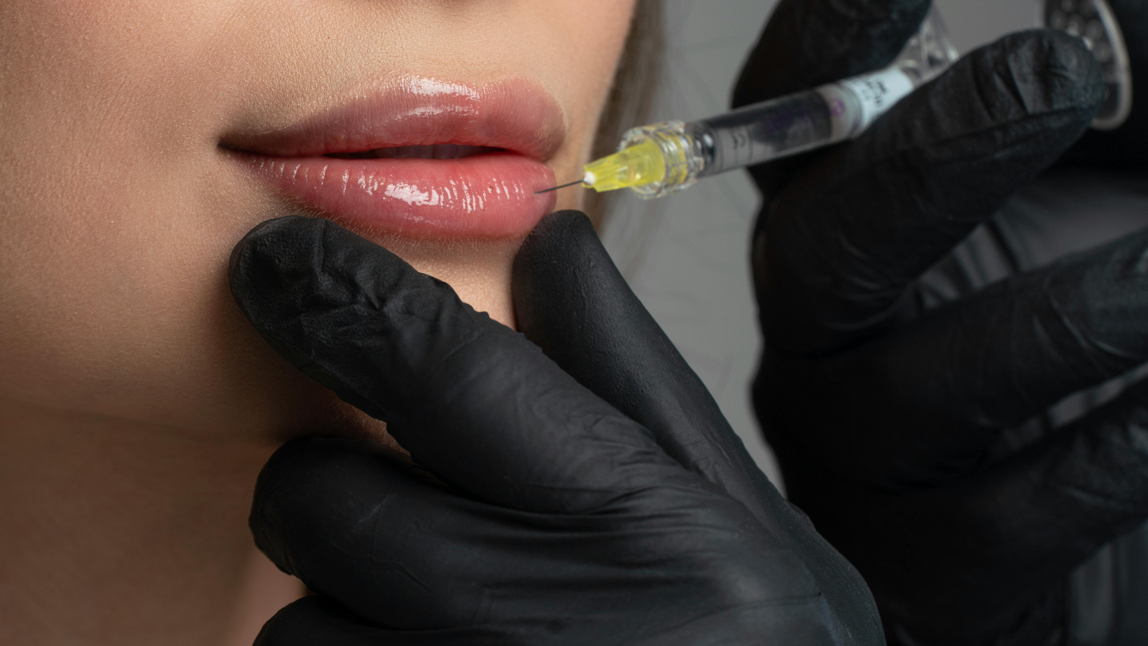 O Segredo da Juventude: Tudo o que Você Precisa Saber sobre Preenchedores (Sem Mistérios!)