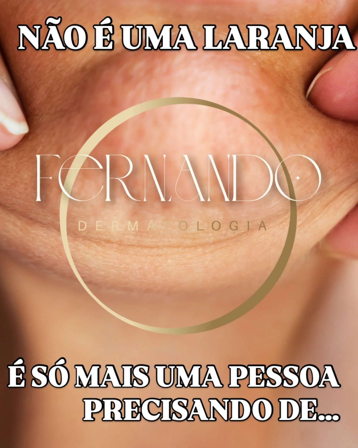 UM BOM DERMATOLOGISTA. 

Botox n&atilde;o &eacute; o &uacute;nico tratamento para esse tipo de condi&ccedil;&atilde;o. 😱

Indica&ccedil;&otilde;es poss&iacute;veis, sem protocolo, sem restri&ccedil;&atilde;o de n&uacute;mero de unidades compradas no