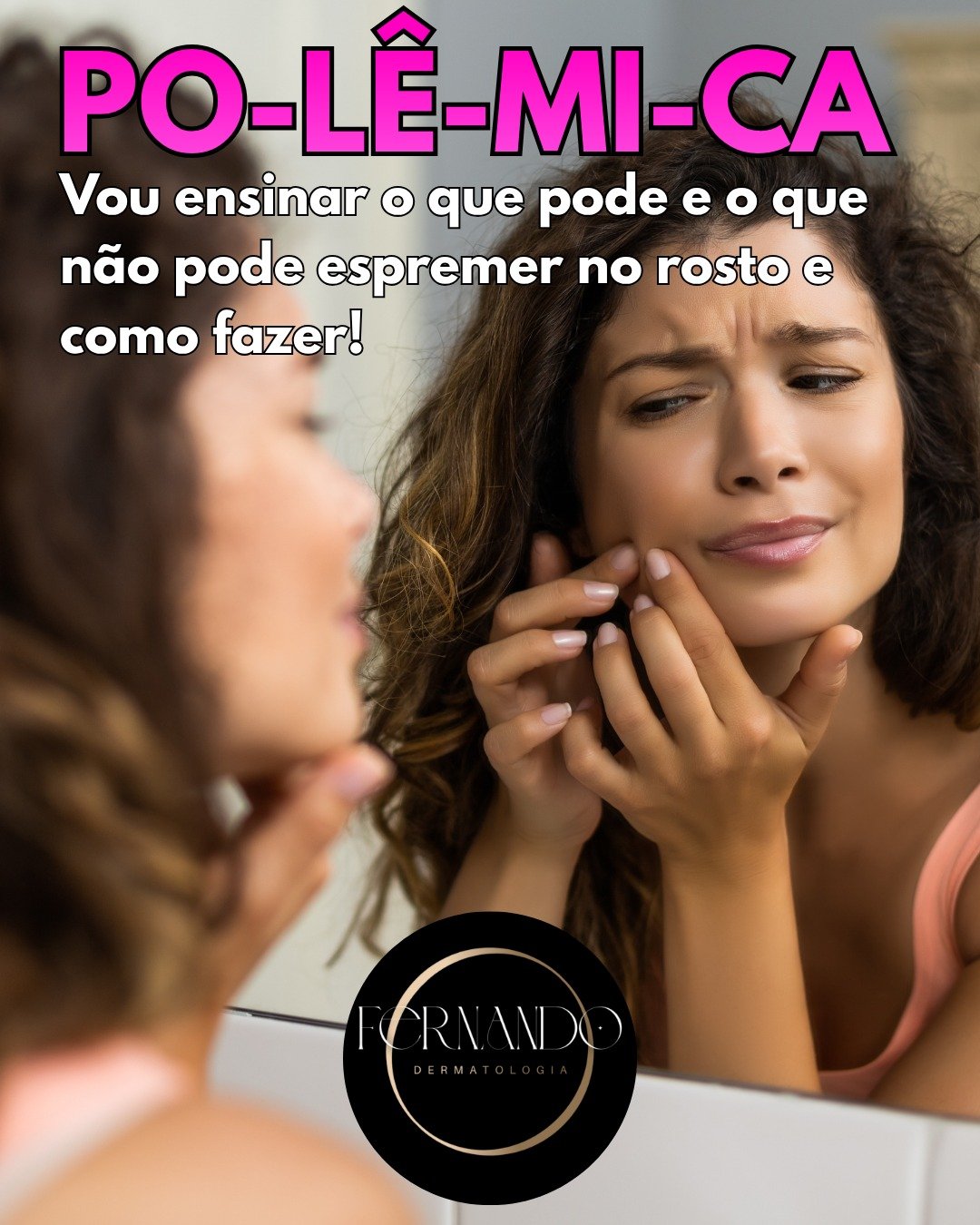 Essa hist&oacute;ria de que n&atilde;o pode espremer nada no rosto &eacute; balela. Est&aacute; no cerne do nosso ser querer espremer as espinhas. Mas vamos com calma!

Voc&ecirc; pode e deve remover cravos pretos, que s&atilde;o os comed&otilde;es a