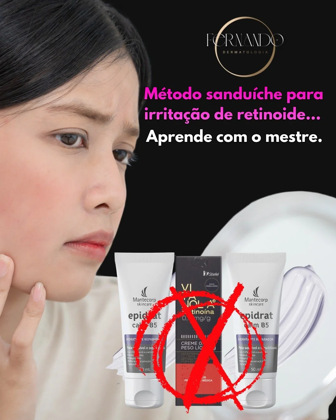 M&eacute;todo sandu&iacute;che para irrita&ccedil;&atilde;o de retinoide&hellip; Hidratante-Retinoide-Hidrandante saindo quentinho!

Tenha d&oacute;, n&eacute;? Sua face n&atilde;o &eacute; o Burger King. 
Retinoide deve ser prescrito por quem entend