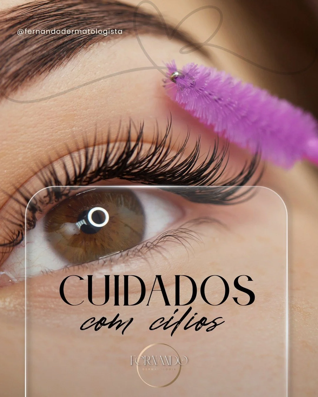 O que diferencia a Minnie do Mickey? Al&eacute;m do la&ccedil;o, s&atilde;o os c&iacute;lios! 🎀

Se voc&ecirc; sentiu que seus c&iacute;lios n&atilde;o est&atilde;o mais como antigamente, calma. Antes de correr para o r&iacute;mel, precisamos invest