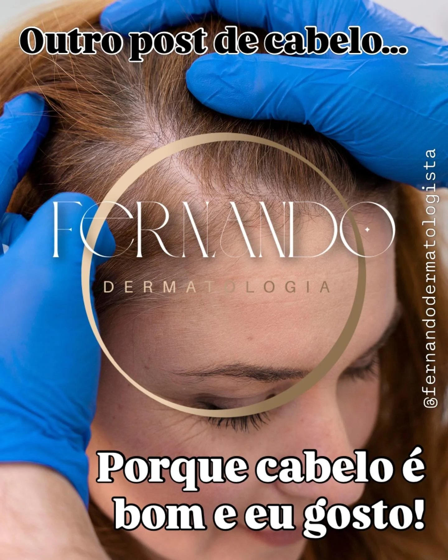 Sa&uacute;de Capilar: Entendendo o Efl&uacute;vio Tel&oacute;geno

A queda capilar acentuada costuma gerar preocupa&ccedil;&atilde;o imediata, mas, na maioria dos casos, estamos diante de um quadro de Efl&uacute;vio Tel&oacute;geno. Diferente da calv