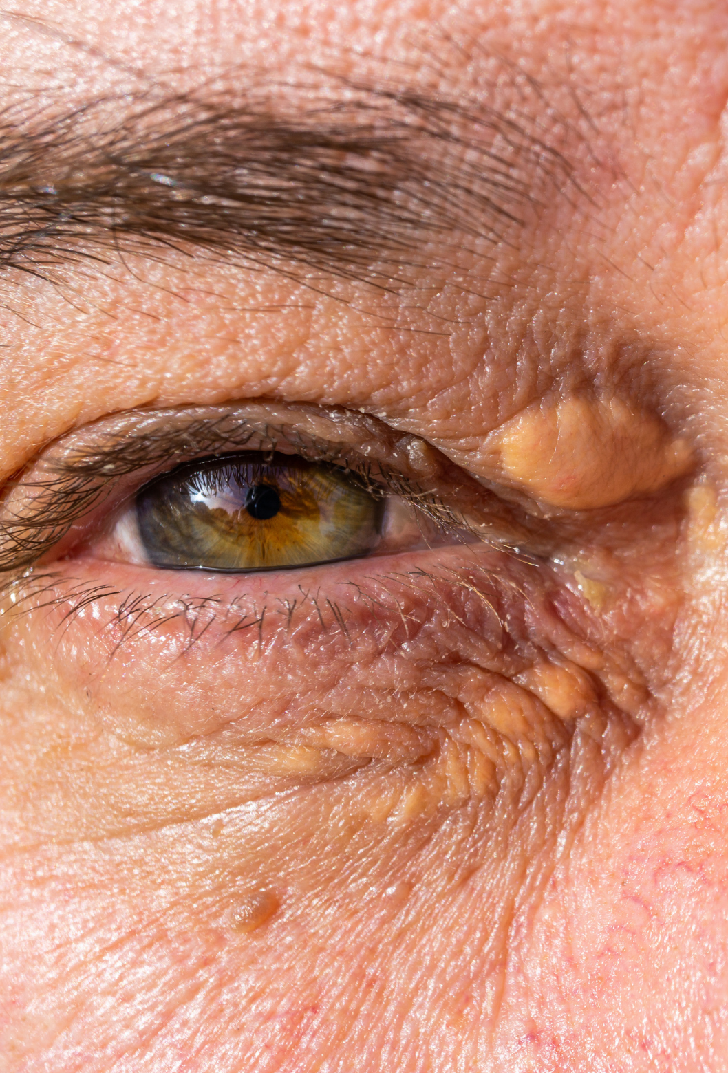Close-up de um olho humano, com pele enrugada ao redor, com íris castanha e pupila preta, refletindo luz.