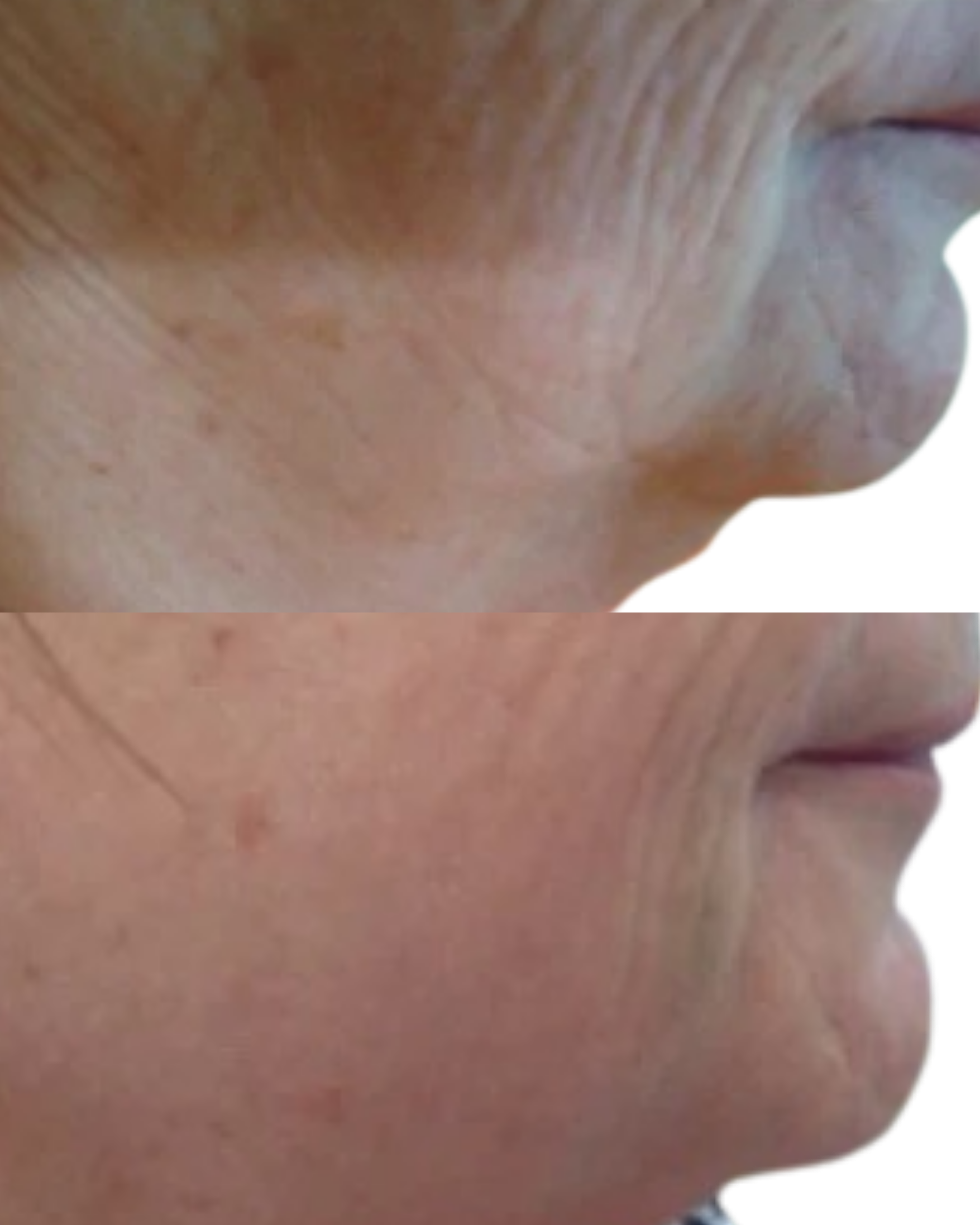 Close-up de uma pele humana, mostrando detalhes de textura e poros, com destaque para linhas finas e tonalidade natural.