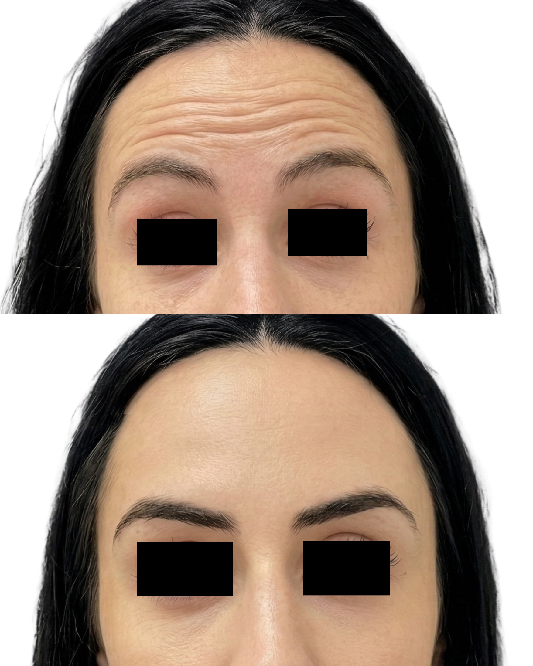 Imagem de close-up do rosto de uma mulher com cabelo preto, sobrancelhas bem definidas e pele clara, com os olhos cobertos por quadrados pretos.
