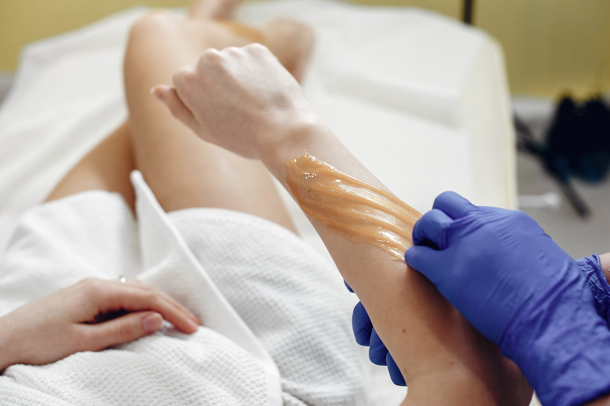 A person receives a waxing treatment on their arm in a clinical setting.