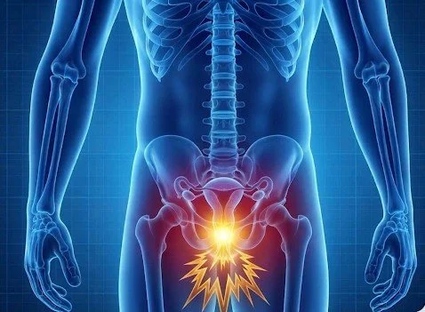 Urination Pain