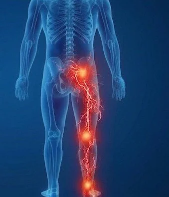 Numbness Leg