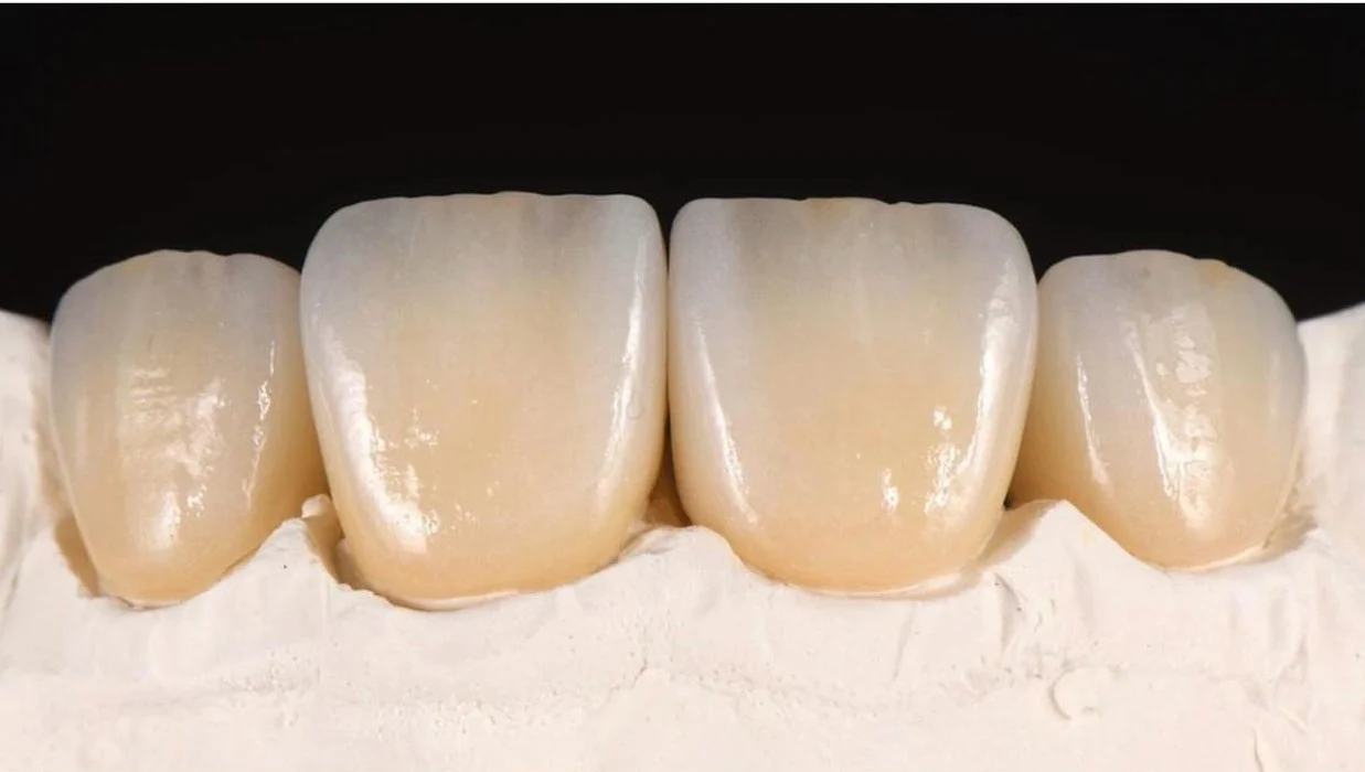 Close-up of four artificial teeth models, showing texture and shape, on a white surface with a black background.