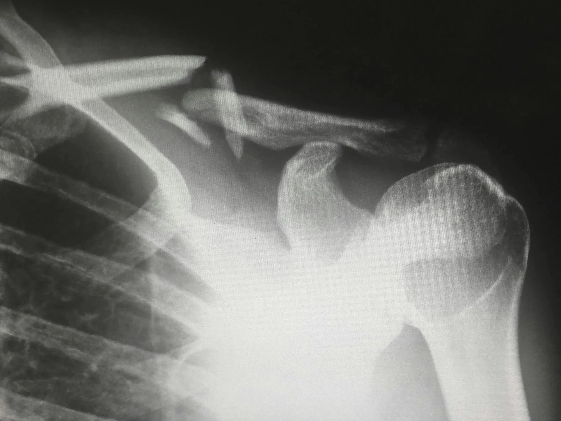 Physiotherapy Gold Coast Dave Coombs Shoulder Knee pain