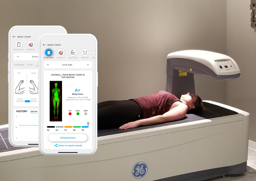 How Can DexaFit DEXA Scan Detect Early Signs of Osteoporosis?
