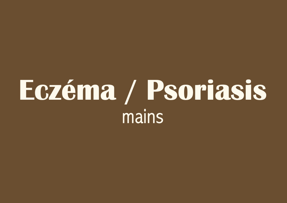Eczéma mains : Inflammation cutanée — Chloé