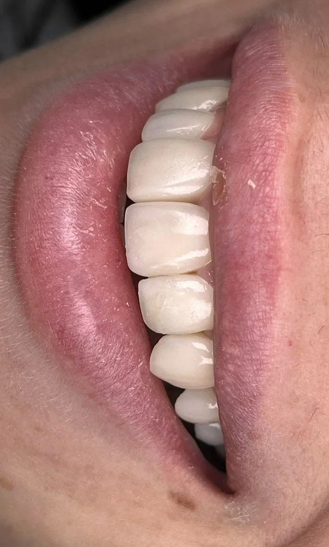 Estetik Diş hekimliği