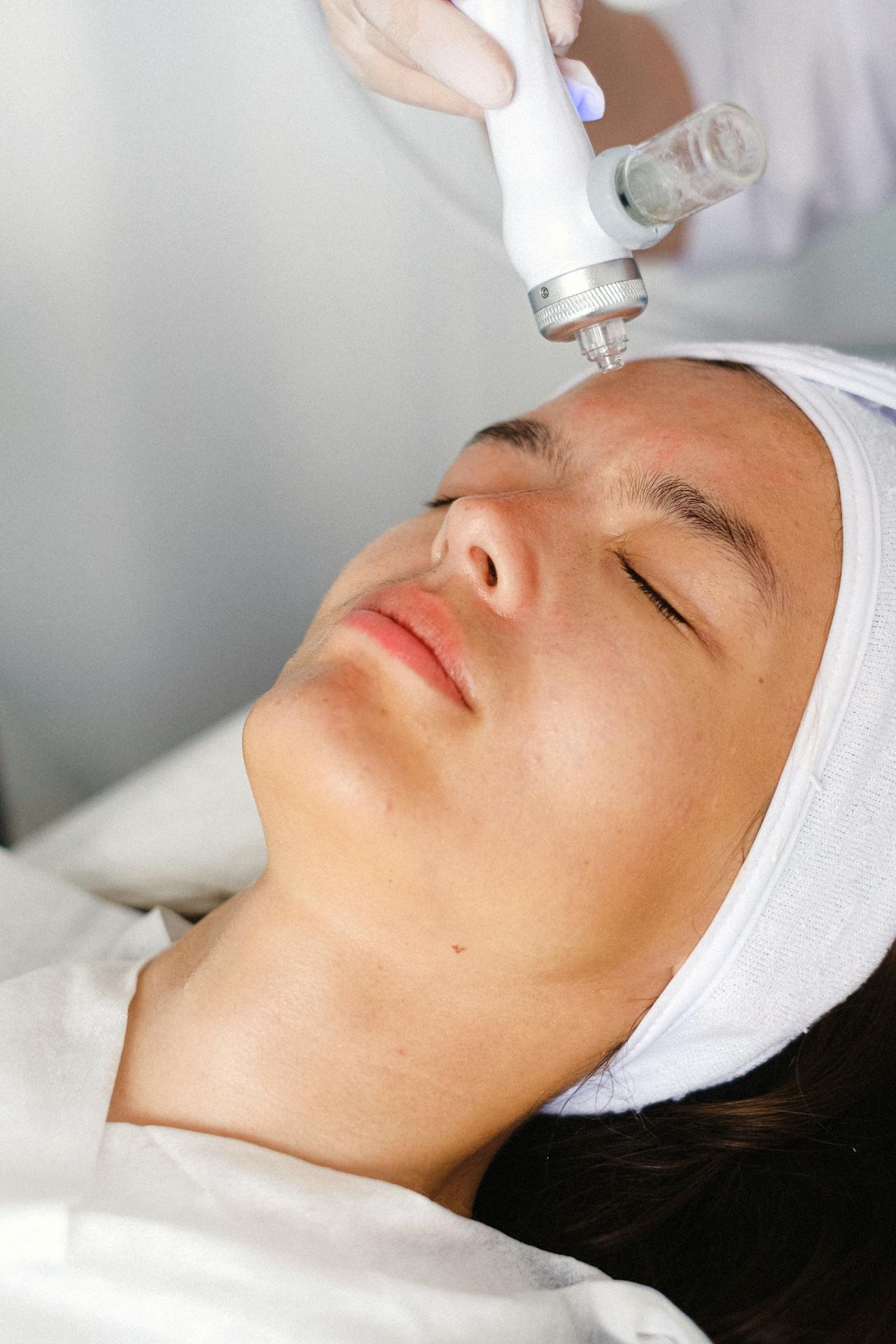 Microneedling treatment being applied to a client's cheek at Silk Skin & Wellness in Woodbridge, VA