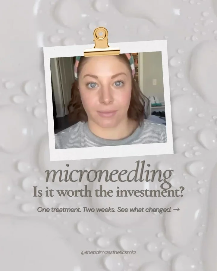 You have the family photos booked. But your skin isn&rsquo;t quite where you want it yet.

Maybe it&rsquo;s the texture you notice when the light hits your face. Fine lines that seem more noticeable in photos. Or skin that just doesn&rsquo;t look as 