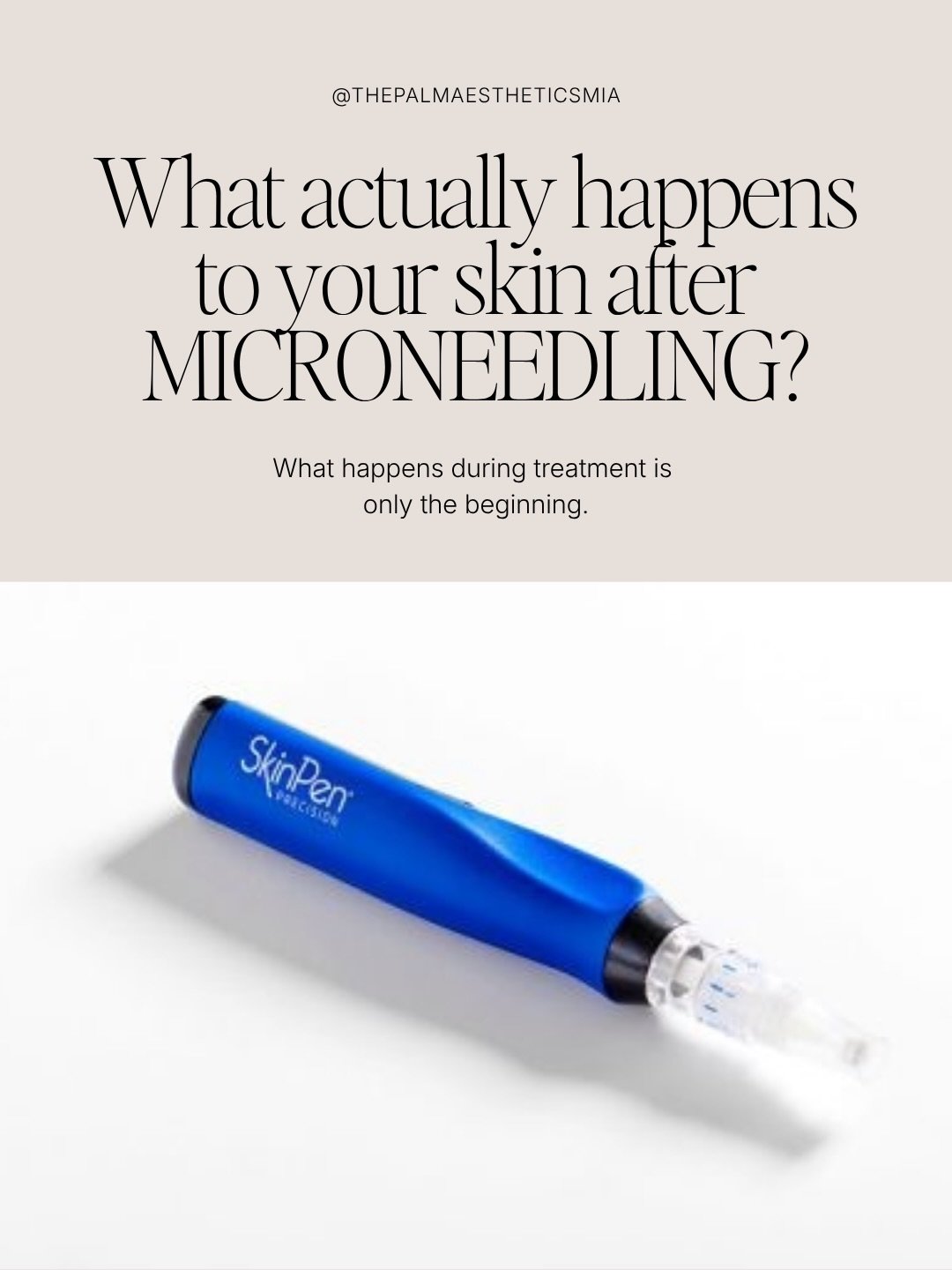 Your skin is still doing the work long after your microneedling appointment is over. 

Pretty interesting, right?

When we use SkinPen microneedling, we&rsquo;re creating tiny, controlled micro-injuries that tell your skin it&rsquo;s time to repair i