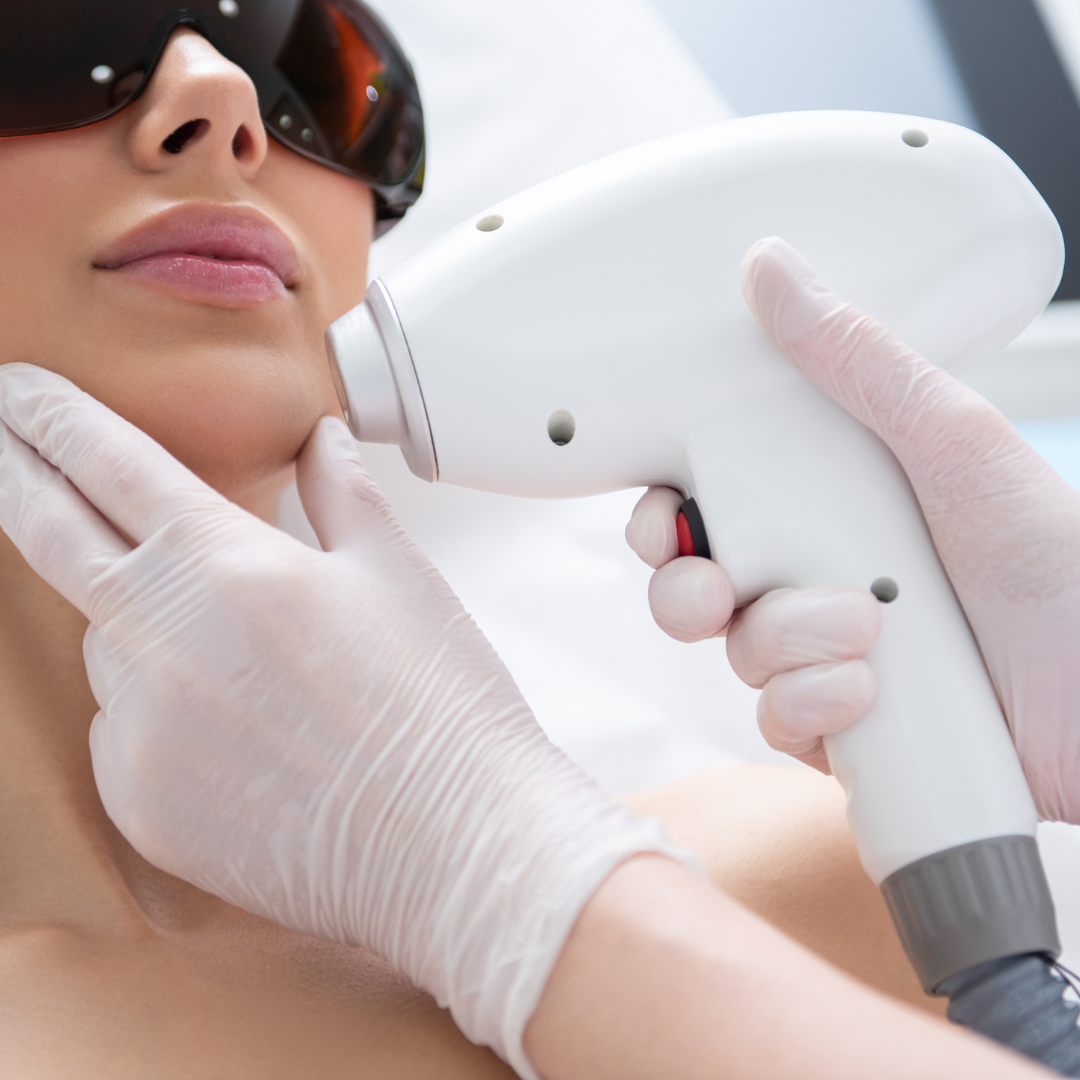A woman receiving a laser skin treatment, wearing protective goggles, with a technician using a handheld laser device on her face.