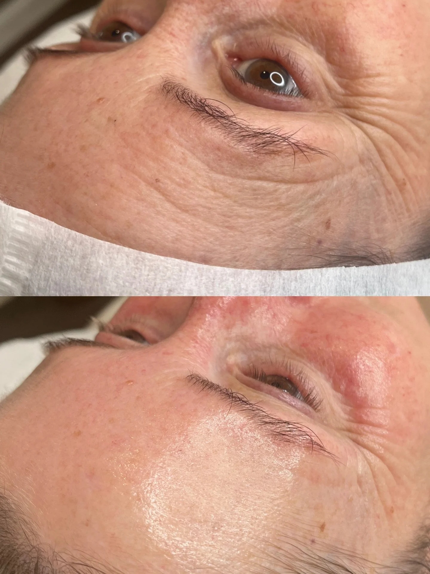 60 minutes of the Fire &amp; Ice facial.
Deep cleanse. Gentle resurfacing. A proper boost of hydration.
The warming phase helps to smooth and refine texture, encouraging fresh, healthy skin to come through. Then the cooling mask calms everything down