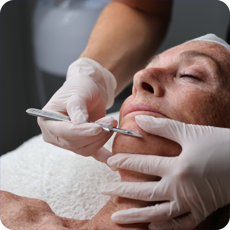 dermaplaning-facial-hair-removal-treatment.png