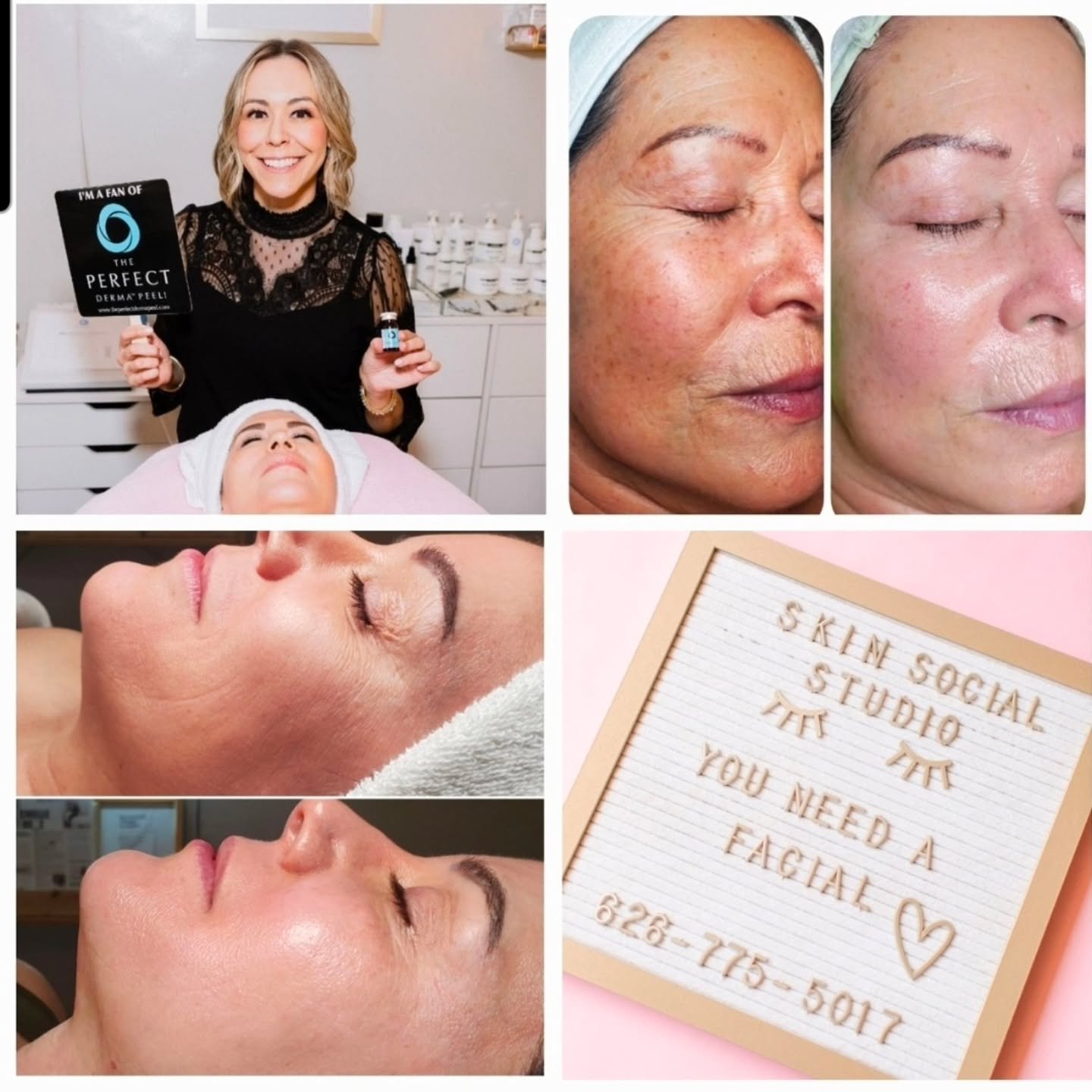 NEW CLIENTS WELCOME 🤍

At Skin Social Studio &amp; Halo Sanctuary, this is more than skincare&hellip;
it&rsquo;s where results meet ritual.

Whether you&rsquo;re ready to correct pigmentation, restore your glow, or reset your nervous system inside t