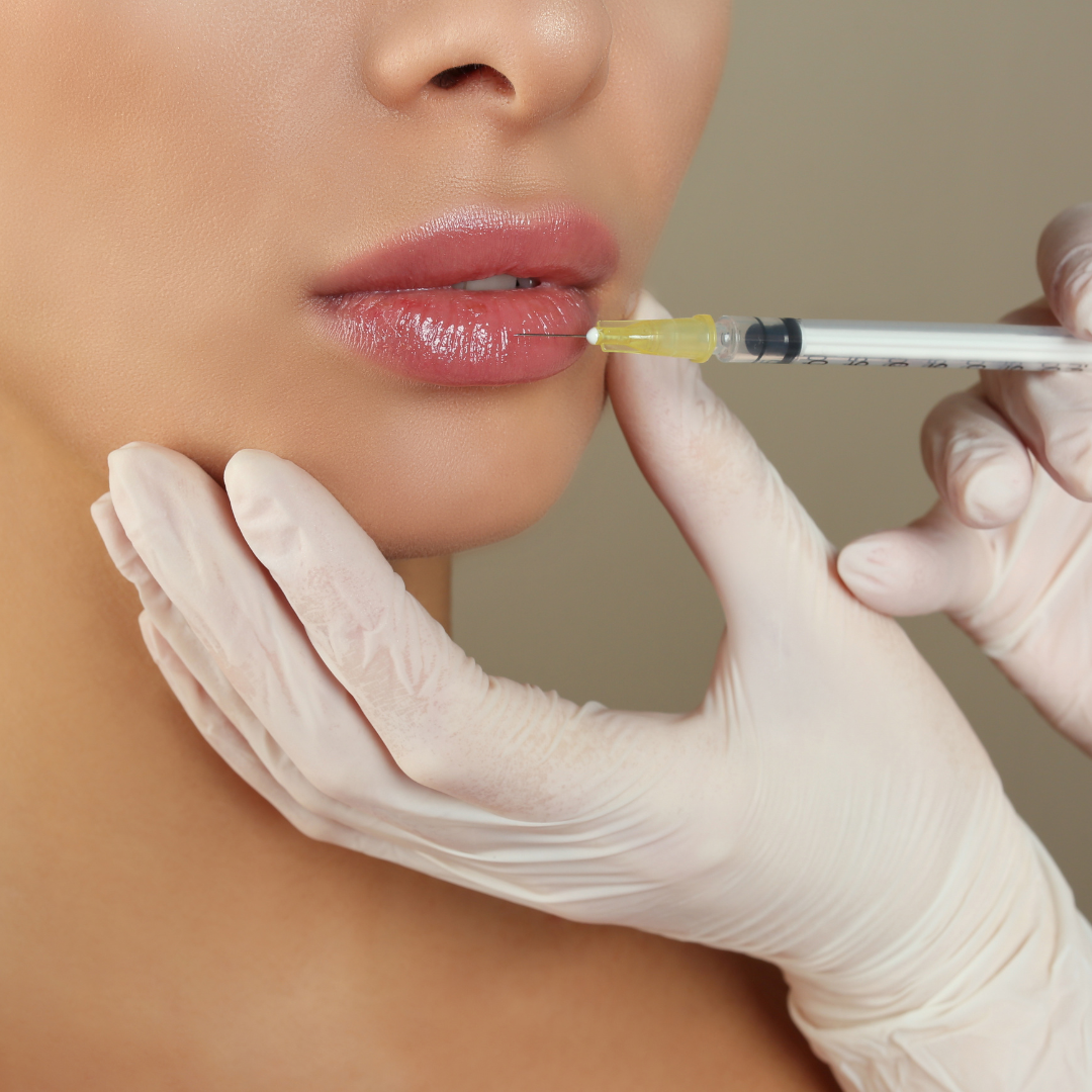 Medspa in Millbrae, CA, 94030 | Lip Fillers Near Me