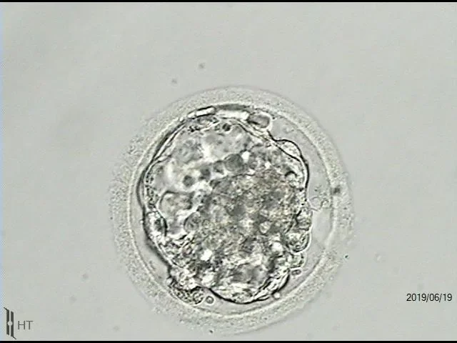 Can You Pursue Surrogacy with Only One Embryo?