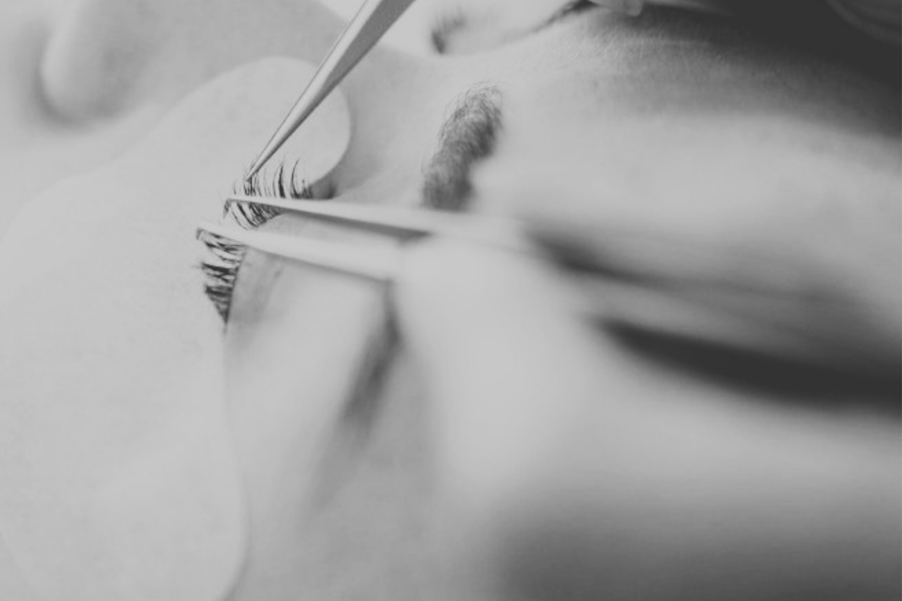 Close-up of eyelashes being examined with tweezers during an eye check-up, black and white photograph.