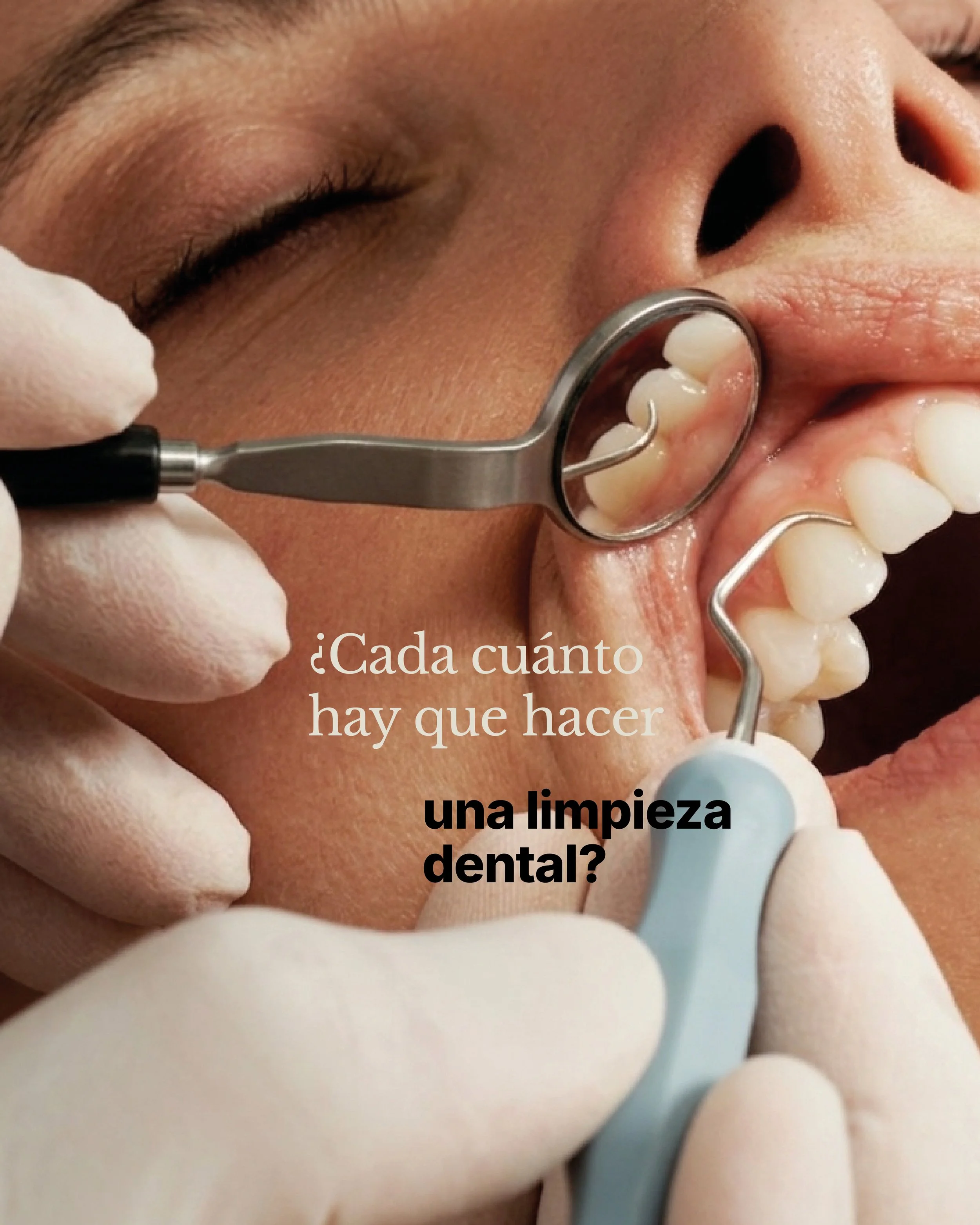 Primer plano del rostro de una persona con los ojos cerrados mientras recibe una limpieza dental; se aprecian instrumentos dentales y guantes.