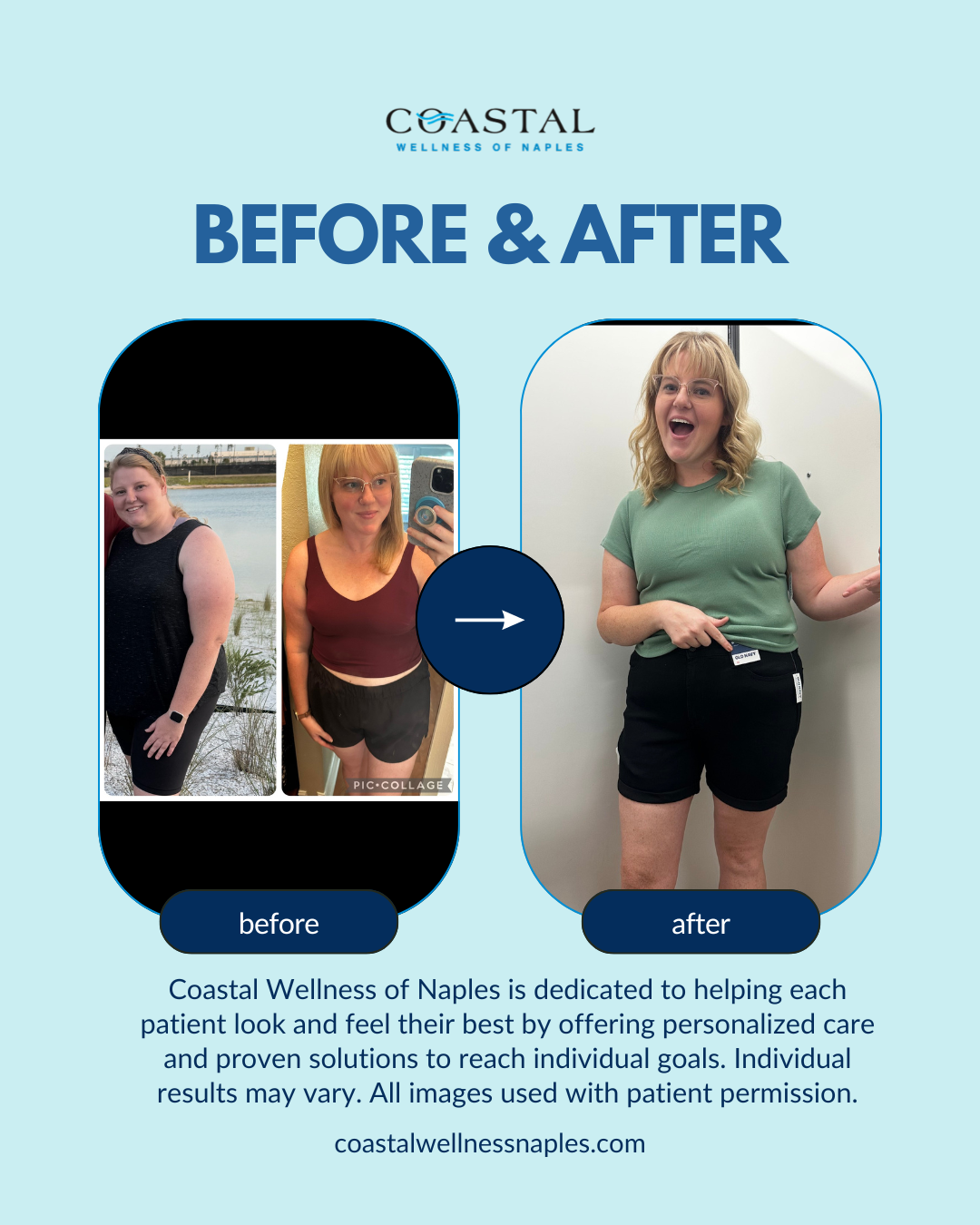 )Coastal- BEFOREAFTER.png